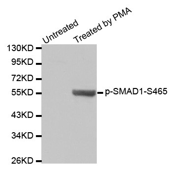 Western blot analysis of extracts from Hela cells using Phospho-SMAD1- S465 antibody. Secondary antibody: HRP Goat Anti- Rabbit IgG (H+L) at 1:10000 dilution. Lysates/proteins: 25ug per lane. Blocking buffer: 3% BSA.