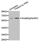 Western blotting using Anti-Phospho SMAD2 S467 antibody on extracts of Untreated and Treated 293T cell lines