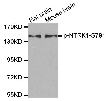 Western blot analysis of extracts from Rat and Mouse brain tissue using Phospho-TRKA-Ser791 antibody.