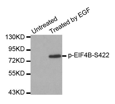 Western blot analysis of extracts from Hela cells using phospho-EIF4B-S422 antibody.
