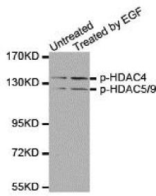Western blot analysis of extracts from 293 cells untreated or treated with EGF using Phospho-HDAC4/5/9-S246/259/220 Antibody.