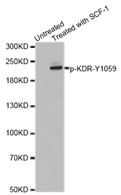 Western blot analysis of extracts from HT29 cells untreated or treated with SCF-1 using Phospho-VEGFR 2 (Tyr1059) antibody.