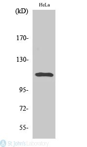 Western Blot (WB) analysis of specific cells using Phospho-Stat2 (Y690) polyclonal antibody.