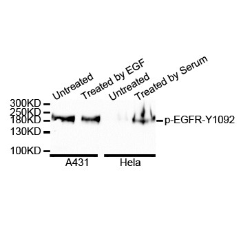 Western blot analysis of extracts of various cell lines extracts of A-431 and HeLa cells, using Phospho-EGFR-Y1068 antibody at 1:1000 dilution. A431 cells were treated by EGF (100ng/ml) for 30 minutes after serum-starvation overnight. HeLa cells were treated by 10% FBS after serum-starvation overnight. Secondary antibody: HRP Goat Anti-Rabbit IgG (H+L) at 1:10000dilution. Lysates/proteins: 25ug per lane Blocking buffer: 3% BSA. Detection: ECLPico Kit Exposure time: 1min.
