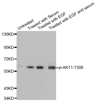 Western blot analysis of extracts from HeLa cells using Phospho-AKT1-T308 antibody (ABP-0304). Secondary antibody: HRP Goat Anti- Rabbit IgG (H+L) at 1:10000 dilution. Lysates/proteins: 25ug per lane. Blocking buffer: 3% BSA.