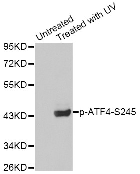 Western blot analysis of extracts from Hela cells using Phospho-ATF4-S245 antibody.