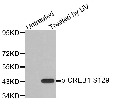 Western blot analysis of extracts from 293 cells, using Phospho-CREB1-S129 antibody.