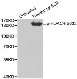 Western blot analysis of extracts from 293 cells using Phospho-HDAC4-S632 antibody