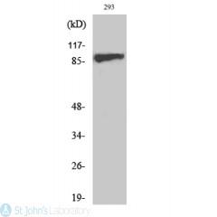 Western Blot (WB) analysis of specific cells using Phospho-IGF-IR (Y1161) Polyclonal Antibody.
