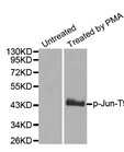 Western blot analysis of extracts from Hela cells, using Phospho-Jun (Thr93) antibody.