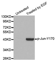 Western blot analysis of extracts from Hela cells, using Phospho- c –Jun (Tyr170) antibody.