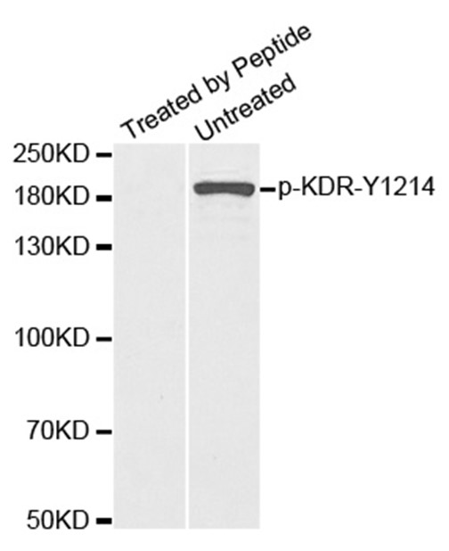 Western blot analysis of extracts from SKOV3 cells using Phospho-VEGFR 2 (Tyr1214) antibody