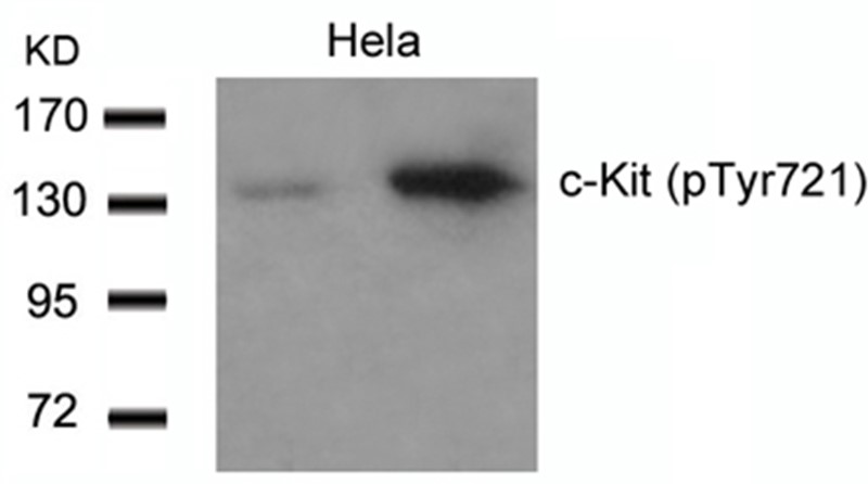 Western blot analysis of extracts from Hela cells untreated or treated using c-Kit(Phospho-Tyr721) Antibody