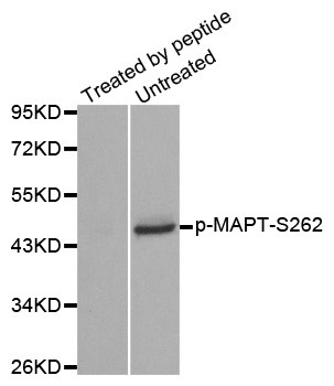Western blot analysis of extracts from mouse brain tissue