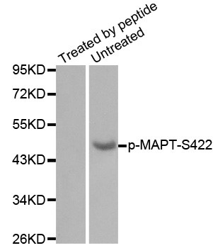 Western blot analysis of extracts from mouse brain tissue using Phospho-TAU-Ser422 antibody.