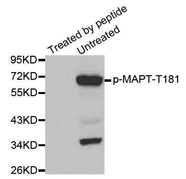 Western blot analysis of extracts from mouse brain tissue using Phospho-Tau-T181 antibody.