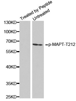 Western blot analysis of extracts from mouse brain tissue using Phospho-TAU-T212 antibody