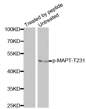 Western blot analysis of extracts from mouse brain tissue using Phospho-TAU-T231 antibody.