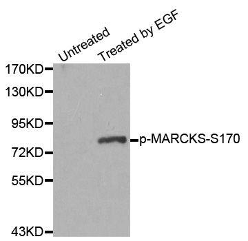 Western blot - phospho-MARCKSS170 antibody