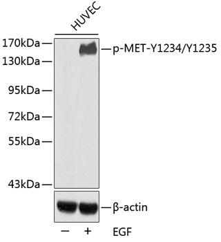 Western blot analysis of extracts from HUVEC cells, using Phospho-MET-Y1234/Y1235 antibody. Secondary antibody: HRP Goat Anti-Rabbit IgG (H+L) at 1:10000 dilution. Lysates/proteins: 25ug per lane. Blocking buffer: 3% BSA.