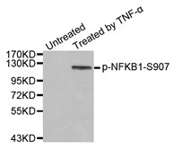 Western blot analysis of extract from HeLa cells, using Phospho-NFKB-p50 (Ser907) antibody.