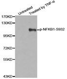 Western blot analysis of extracts from 293 cells untreated or treated with TNF-a using Phospho-NFKB-p50 (Ser932) Ab