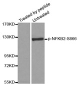 Western blot analysis of extracts from ovary cancer cells, using Phospho-NFKB-p52 (Ser866) antibody.