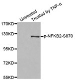 Western blot analysis of extract from MDA-MB-435 cells, using Phospho-NFKB-p52 (Ser870) antibody