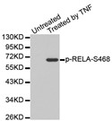 Western blot analysis of extracts from Hela cells, using Phospho-NFKB-p65-S468 antibody