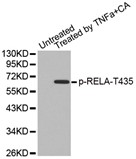 Western blot analysis of extracts from Hela cells, using Phospho-NFKB-p65 (Thr435) antibody.