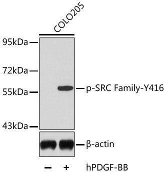 Western blot analysis of extracts from COLO205 cells, using Phospho-SRC Family-Y416 antibody.