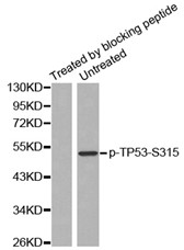 Phospho-p53 (Ser315) Antibody detects endogenous levels of p53 only when phosphorylated at serine 315