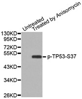 Western blot analysis of extracts from MCF cells, using Phospho-p53 (Ser37) antibody