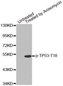 Western blot analysis of extracts from MDA cells, using phospho-TP53-T18 antibody.