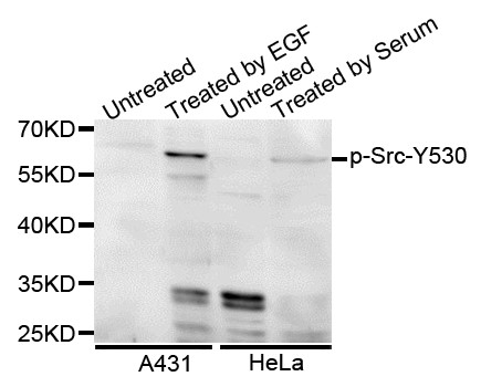 Western blot analysis of extracts of various cell lines, using Phospho-Src-Y527 antibody.