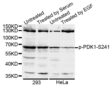 Western blot analysis of extracts of various cell lines, using Phospho-PDK1-S241 antibody.