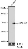 Western blot analysis of extracts of NIH3T3 cells, using Phospho-YAP1-S127 antibody at 1:1000 dilution.NIH3T3 cells were treated by Sorbitol (0.2M) at 37℃ for 60 minutes after serum starvation overnight. Secondary antibody: HRP Goat Anti-Rabbit IgG (H+L) at 1:10000 dilution. Lysates/proteins: 25ug per lane. Blocking buffer: 3% BSA. Detection: ECL West Pico Plus Exposure time: 60s.