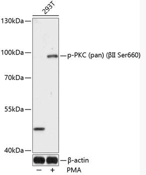 Western blot analysis of extracts of 293T cells, using Phospho-PKC (pan) (βII Ser660) antibody at 1:1000 dilution. 293T cells were treated by PMA/TPA (200nM) for 30 minutes after serum-starvation overnight. Secondary antibody: HRP Goat Anti-Rabbit IgG (H+L) at 1:10000 dilution. Lysates/proteins: 25ug per lane. Blocking buffer: 3% BSA. Detection: ECLWest Pico Plus. Exposure time: 90s.