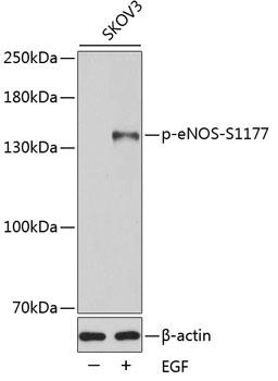 Western blot analysis of extracts of SKOV3 cells, using Phospho-eNOS S1177 antibody SKOV3cells were treated by EGF. Secondary antibody: HRP Goat Anti-Rabbit IgG (H+L) at 1:10000 dilution. Lysates/proteins: 25ug per lane.  Blocking buffer: 3% BSA.