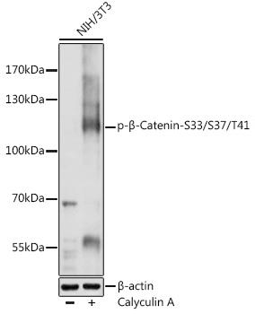 Western blot analysis of extracts of NIH/3T3 cells, using Phospho-β-Catenin-S33/S37/T41 antibody at 1:1000 dilution.NIH/3T3 cells were treated by Calyculin A (10ul) at 37℃ for 30 minutes after serum-starvation overnight. Secondary antibody: HRP Goat Anti-Rabbit IgG (H+L) at 1:10000 dilution. Lysates/proteins: 25ug per lane. Blocking buffer: 3% nonfat dry milk in TBST. Detection: ECL West Pico Plus. Exposure time: 1s.