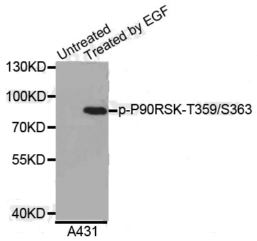 Western blot analysis of extracts of A431 cells, using Phospho-P90RSKT359/ S363 antibody. Secondary antibody: HRP Goat Anti- Rabbit IgG (H+L) at 1:10000 dilution. Lysates/proteins: 25ug per lane. Blocking buffer: 3% BSA.