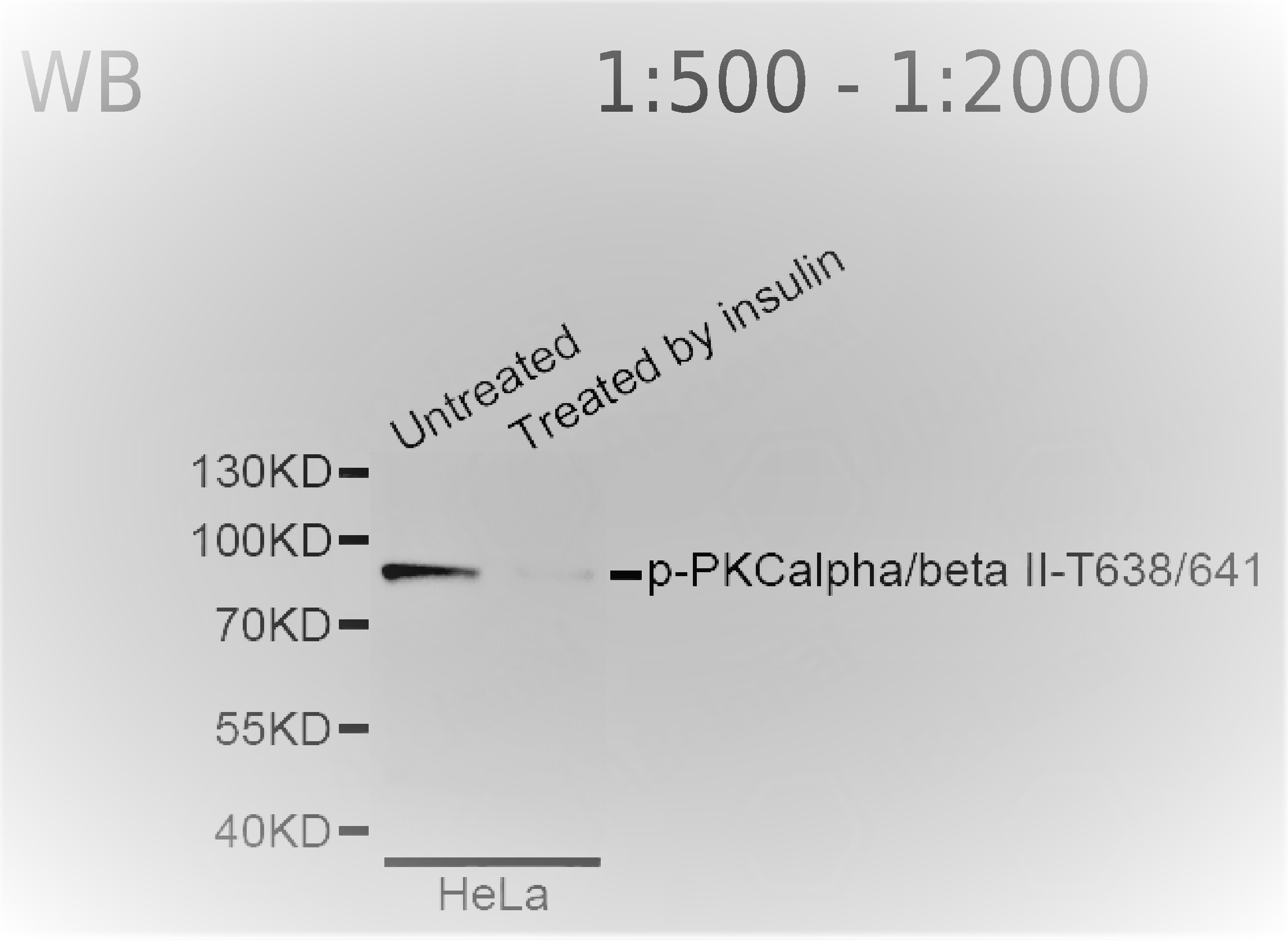 Western blot analysis of extracts of HeLa cells, using Phospho-PKCalpha/beta II-T638/641 antibody.