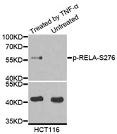 Western blot analysis of extracts from various cell lines using Phospho-NFKB-p65 (Ser276) antibody.