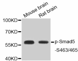 Western blot analysis of extracts of   various cells, using Phospho-Smad5- S463/465 antibody.    Secondary antibody: HRP Goat Anti-  Rabbit IgG (H+L) at 1:10000  dilution. Lysates/proteins: 25ug per lane.   Blocking buffer: 3% BSA.