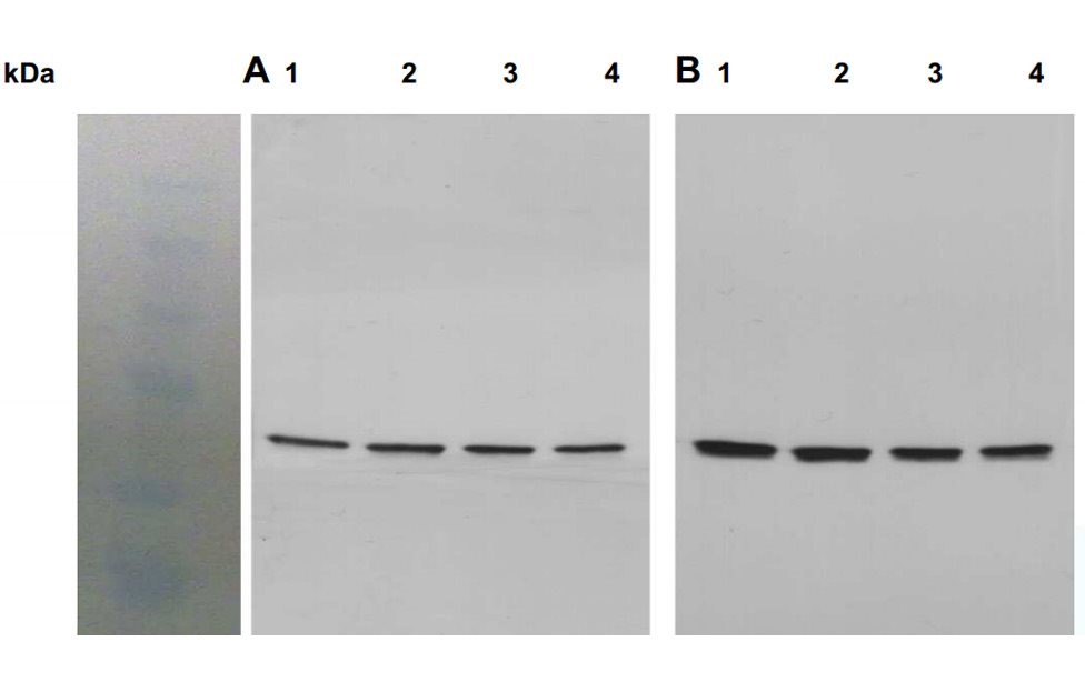 A) Western blot analysis of Akt activation in striatal neurons stimulated with DHPG (mGluR5 agonist) for 0 (lane 1), 2 (lane 2), 5 (lane 3) or 10 (lane 4) min. (B) Western blot analysis of total Akt (detected with anti-Akt1 antibody, in striatal neurons stimulated with DHPG (a mGluR5 agonist) for 0 (lane 1), 2 (lane 2), 5 (lane 3) or 10 (lane 4) min. Wells were equally loaded with 100 μg of whole cell lysate proteins.