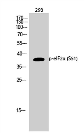 Western blot analysys of 293 cells  Using Phospho-EIF2 (S51) Alpha Polyclonal antibody diluted at 1:1000