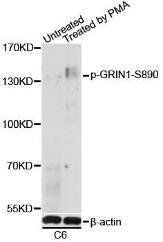 Western blot analysis of extracts of C6 cells, using Phospho-GRIN1-S890 antibody at 1:1000 dilution. C6 cells were treated by PMA/TPA (200nM) for 30 minutes after serumstarvation overnight. Secondary antibody: HRP Goat Anti- Rabbit IgG (H+L) at 1:10000 dilution. Lysates/proteins: 25ug per lane. Blocking buffer: 3% BSA. Detection: ECL Basic Kit. Exposure time: 90s.