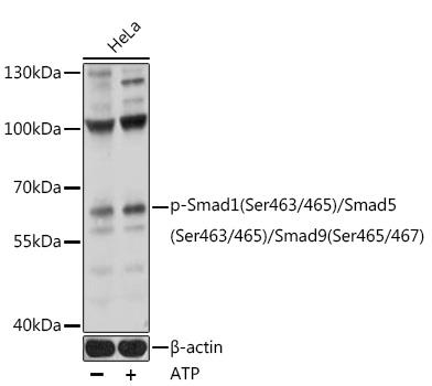 Western blot analysis of extracts of HeLa cells, using PhosphoSmad1(Ser463/465)/Smad5(Ser463/465)/Smad 9(Ser465/467) Polyclonal antibody at 1:1000 dilution.HeLa cells were treated by ATP (5 mM) at 30℃ for 1 hour. Secondary antibody: HRP Goat Anti-Rabbit IgG (H+L) at 1:10000 dilution. Lysates/proteins: 25ug per lane. Blocking buffer: 3% BSA. Detection: ECL West Pico Plus. Exposure time: 60s.