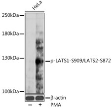 Western blot analysis of extracts of HeLa cells, using phospho-LATS1-S909/LATS2-S872 antibody at 1:1000 dilution.HeLa cells were treated by PMA/TPA (200 nM) at 37℃ for 15 minutes after serum-starvation overnight. Secondary antibody: HRP Goat Anti-Rabbit IgG (H+L) at 1:10000 dilution. Lysates/proteins: 25ug per lane. Blocking buffer: 3% BSA. Detection: ECL West Pico. Exposure time: 90s.