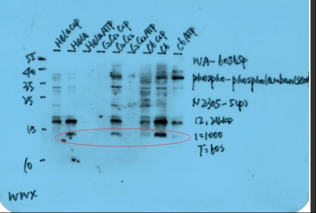 Western blot on different Cells